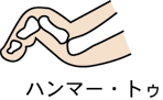 ハンマー・トゥ